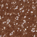 Immunohistochemical staining of human cerebral cortex shows strong cytoplasmic positivity in neuropil.