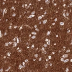 Immunohistochemical staining of human cerebral cortex shows strong cytoplasmic positivity in neuropil.