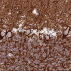 Immunohistochemical staining of human cerebellum shows strong membranous positivity in Purkinje cells.