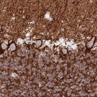 Immunohistochemical staining of human cerebellum shows strong membranous positivity in Purkinje cells.