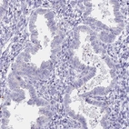 Immunohistochemical staining of human endometrium shows no positivity in glandular cells as expected.