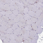 Immunohistochemical staining of human skeletal muscle shows no positivity in myocytes as expected.