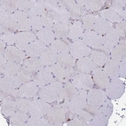 Immunohistochemical staining of human skeletal muscle shows no positivity in myocytes as expected.