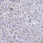 Anti-TRIM64 Antibody