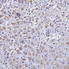 Anti-TRIM64 Antibody