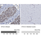 Anti-STC2 Antibody