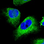 Anti-STC2 Antibody