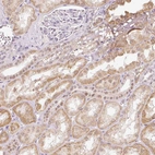 Immunohistochemical staining of human kidney shows moderate cytoplasmic positivity in cells in tubules.