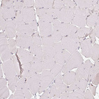 Immunohistochemical staining of human skeletal muscle shows no positivity in myocytes as expected.
