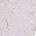 Immunohistochemical staining of human skeletal muscle shows no positivity in myocytes as expected.