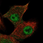 Immunofluorescent staining of human cell line A549 shows localization to nucleoplasm.