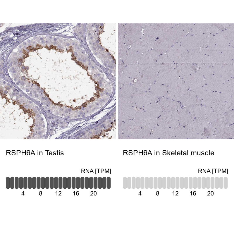 Anti-RSPH6A Antibody