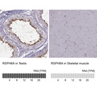 Anti-RSPH6A Antibody