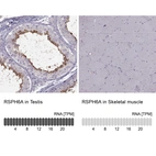Anti-RSPH6A Antibody