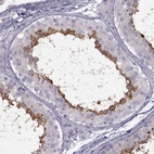 Immunohistochemical staining of human testis shows moderate positivity in spermatocytes.
