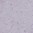 Immunohistochemical staining of human skeletal muscle shows no positivity as expected.