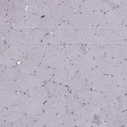 Immunohistochemical staining of human skeletal muscle shows no positivity as expected.
