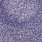 Anti-RSPH6A Antibody