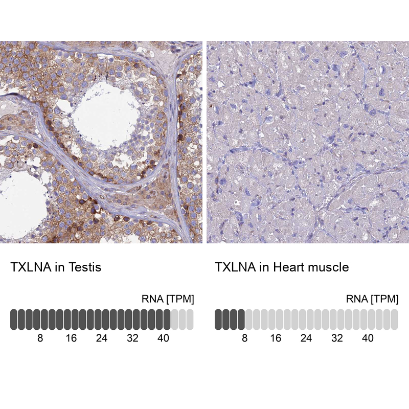 Anti-TXLNA Antibody