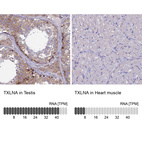 Anti-TXLNA Antibody