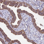 Immunohistochemical staining of human Fallopian tube shows moderate cytoplasmic/membranous positivity in glandular cells.