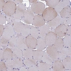 Immunohistochemical staining of human skeletal muscle shows low cytoplasmic positivity in myocytes as expected.
