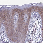 Immunohistochemical staining of human skin shows weak to moderate cytoplasmic positivity in squamous epithelial cells.