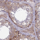 Immunohistochemical staining of human testis shows moderate cytoplasmic positivity in cells in seminiferous ducts.