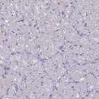 Immunohistochemical staining of human heart muscle shows no positivity in cardiomyocytes as expected.