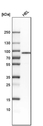 Western blot analysis in human cell line HEL.