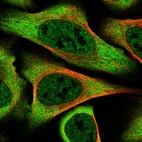 Immunofluorescent staining of human cell line U-2 OS shows localization to nucleoplasm & cytosol.