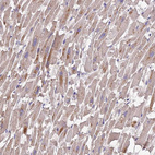 Anti-PGK1 Antibody