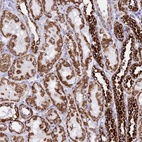 Anti-PKN3 Antibody