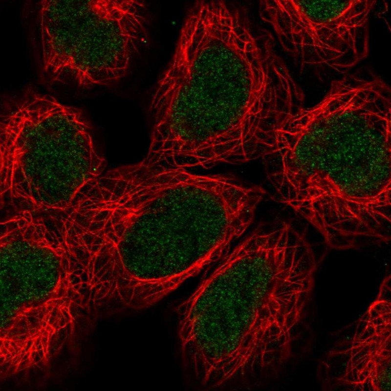Anti-ALKBH2 Antibody