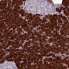 Anti-AMY1A Antibody