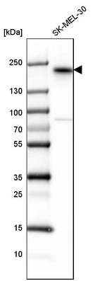 Western blot analysis in human cell line SK-MEL-30.