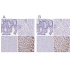 Immunohistochemical staining of human gastrointestinal, kidney, liver and stomach using Anti-ATP4B antibody HPA045400 (A) shows similar protein distribution across tissues to independent antibody HPA052649 (B).