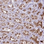 Immunohistochemical staining of human stomach shows strong cytoplasmic positivity in glandular cells.