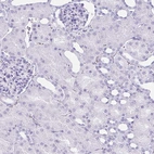 Immunohistochemical staining of human kidney shows no positivity in cells in tubules as expected.