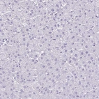 Immunohistochemical staining of human liver shows no positivity in hepatocytes as expected.
