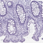 Immunohistochemical staining of human colon shows no positivity in glandular cells as expected.