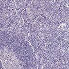 Immunohistochemical staining of human tonsil shows no positivity in non-germinal center cells as expected.