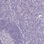 Immunohistochemical staining of human tonsil shows no positivity in non-germinal center cells as expected.