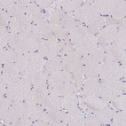 Immunohistochemical staining of human skeletal muscle shows no positivity in myocytes as expected.