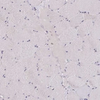 Immunohistochemical staining of human skeletal muscle shows no positivity in myocytes as expected.