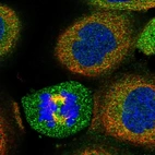 Immunofluorescent staining of human cell line A-431 shows positivity in cytoplasm.