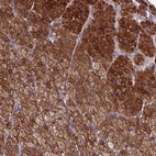 Anti-CLHC1 Antibody