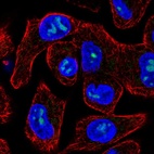 Immunofluorescent staining of human cell line RT4 shows localization to nucleoli.
