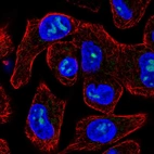 Immunofluorescent staining of human cell line RT4 shows localization to nucleoli.