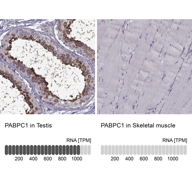 Anti-PABPC1 Antibody